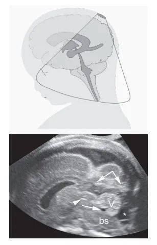 超研股份：超声在颅脑应用已获多项专利