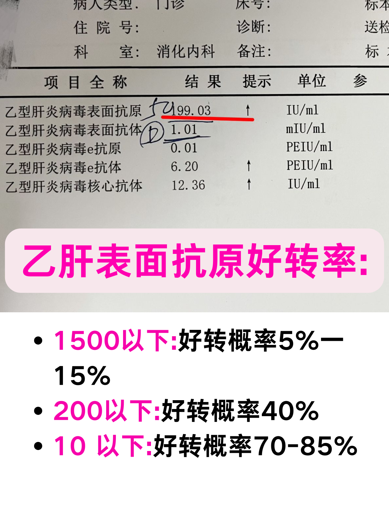 基于血检的新模型可预测患严重肝病风险